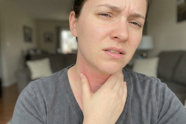 Why Stress Makes Your Skin Feel Hot