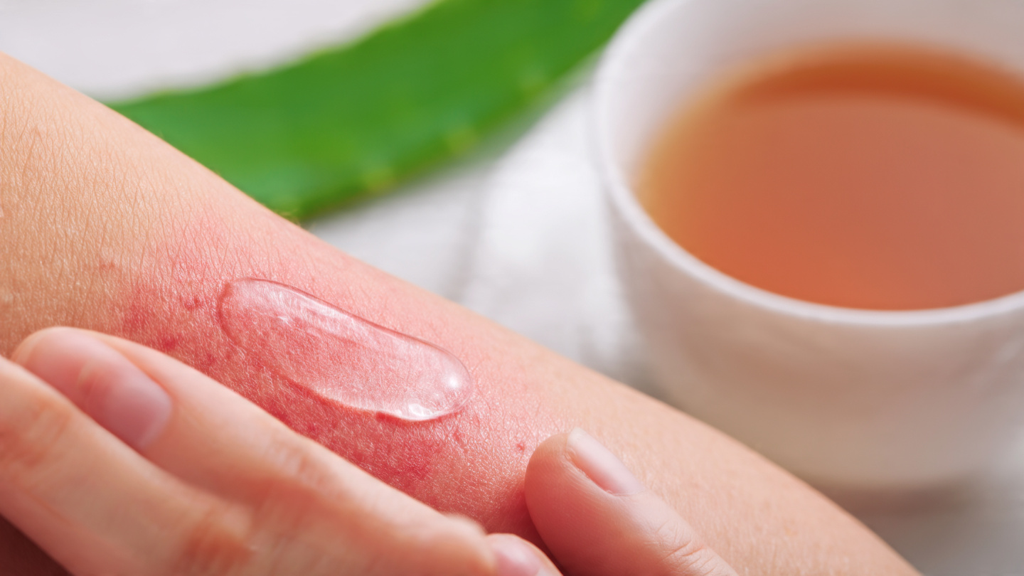 Healing skin irritation with a natural chamomile and aloe vera treatment.