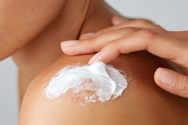Applying a rich moisturizing cream to treat dry peeling skin on the arm.